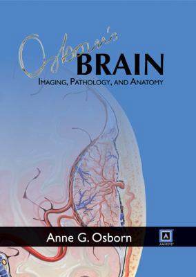 Osborn's Brain 1931884218 Book Cover