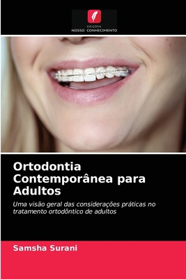Ortodontia Contemporânea para Adultos [Portuguese] 620350467X Book Cover