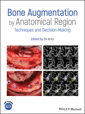 Bone Augmentation by Anatomical Region: Techniq... 1119427843 Book Cover