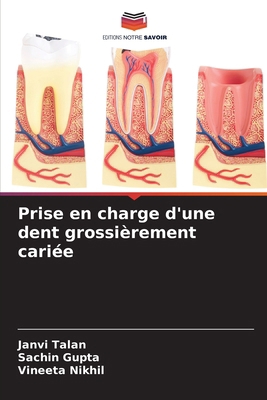 Prise en charge d'une dent grossièrement cariée [French] 6207766806 Book Cover