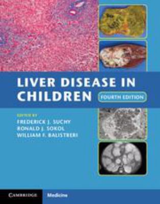Liver Disease in Children 113901210X Book Cover
