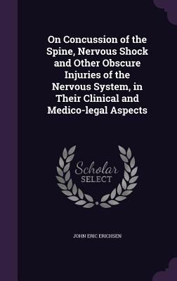 On Concussion of the Spine, Nervous Shock and O... 1355213908 Book Cover