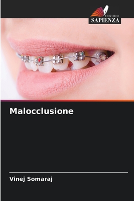 Malocclusione [Italian] 6205626543 Book Cover