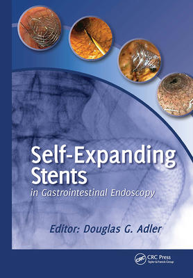 Self-Expanding Stents in Gastrointestinal Endos... 1617110280 Book Cover
