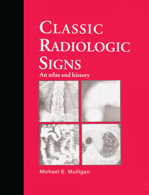 Classic Radiologic Signs: An Atlas and History 0367401150 Book Cover