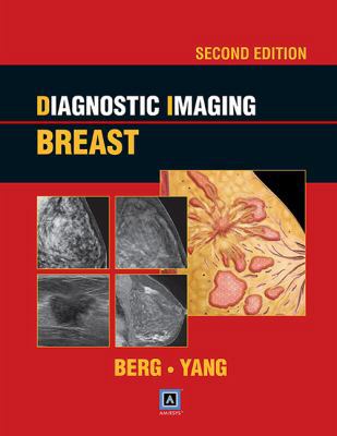 Diagnostic Imaging: Breast 1931884730 Book Cover