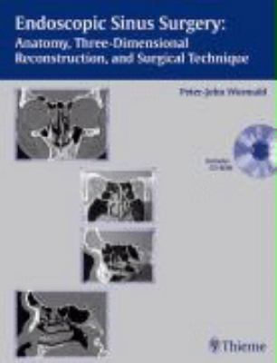 Endoscopic Sinus Surgery: Anatomy, Three-dimens... [German] 3131394218 Book Cover