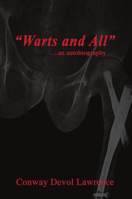 Warts And All: An Autobiography 1090345372 Book Cover