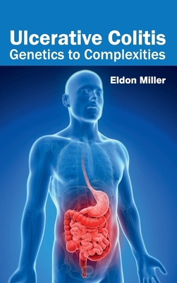 Ulcerative Colitis: Genetics to Complexities 1632424142 Book Cover