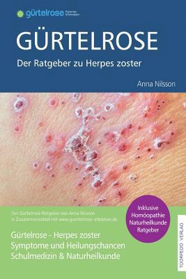 Gürtelrose - Der große Ratgeber zu Herpes zoste... [German] 1532701675 Book Cover