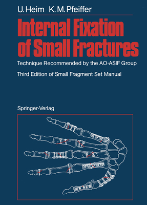 Internal Fixation of Small Fractures: Technique... 364272616X Book Cover