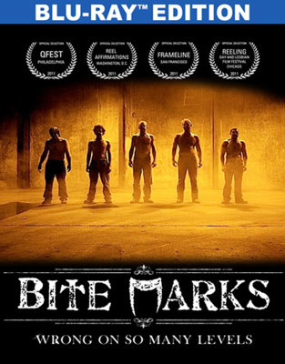 Bite Marks 6316305249 Book Cover