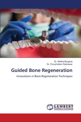 Guided Bone Regeneration 6209495222 Book Cover