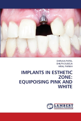Implants in Esthetic Zone: Equipoising Pink and... 6207843924 Book Cover