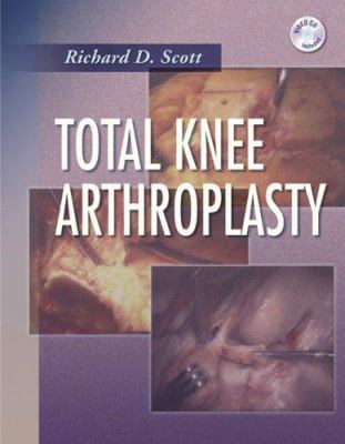 Total Knee Arthroplasty [With CDROM] 0721639488 Book Cover
