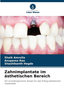 Zahnimplantate im ästhetischen Bereich [German] 620902629X Book Cover