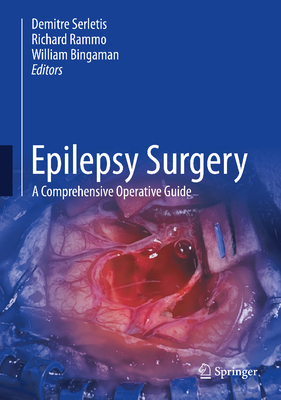 Epilepsy Surgery: A Comprehensive Operative Guide 3032399963 Book Cover