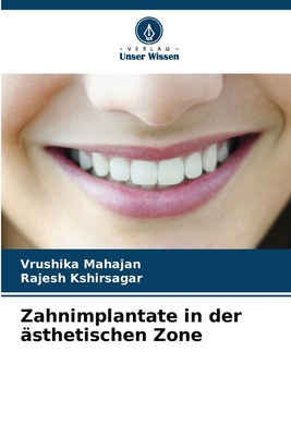 Zahnimplantate in der ästhetischen Zone [German] 6207259734 Book Cover