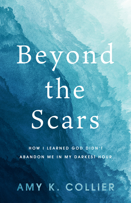 Beyond the Scars: How I Learned God Didn't Aban... 1563096196 Book Cover