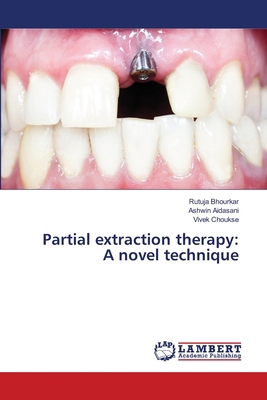 Partial extraction therapy: A novel technique 6207995023 Book Cover