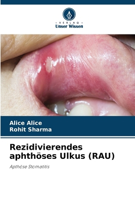 Rezidivierendes aphthöses Ulkus (RAU) [German] 6207418832 Book Cover