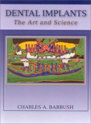 Dental Implants: The Art and Science 0721677479 Book Cover