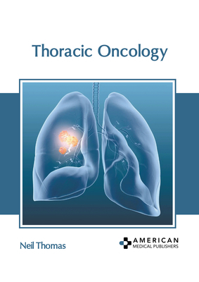 Thoracic Oncology B0CFQ742XZ Book Cover