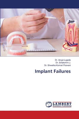 Implant Failures 3330320001 Book Cover