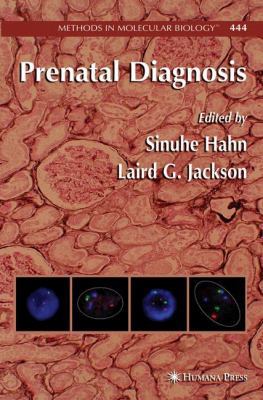 Prenatal Diagnosis 1588298035 Book Cover