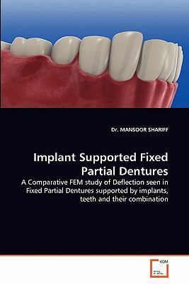Implant Supported Fixed Partial Dentures 3639356497 Book Cover