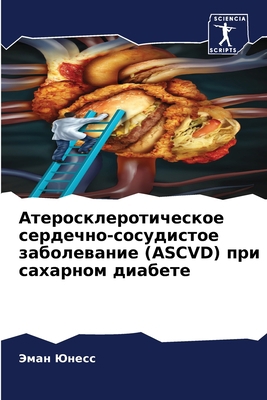 Атеросl... [Russian] 6205728370 Book Cover