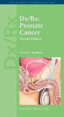 DX/Rx: Prostate Cancer: Prostate Cancer 0763794538 Book Cover