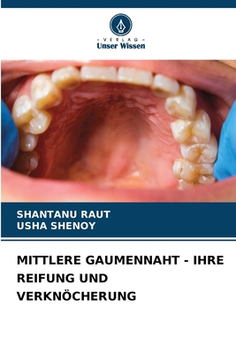Mittlere Gaumennaht - Ihre Reifung Und Verknöch... [German] 6202334525 Book Cover
