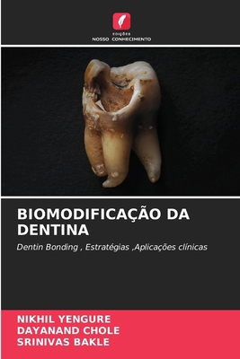 Biomodificação Da Dentina [Portuguese] 6207103742 Book Cover