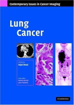 Lung Cancer 0521872022 Book Cover