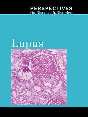 Lupus 0737747897 Book Cover