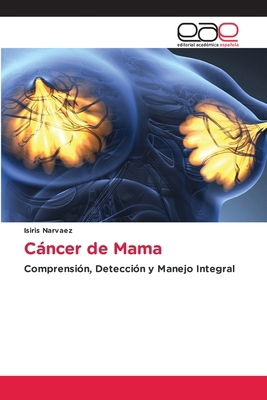 Cáncer de Mama [Spanish] 6209373631 Book Cover