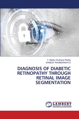 Diagnosis of Diabetic Retinopathy Through Retin... 6207475550 Book Cover