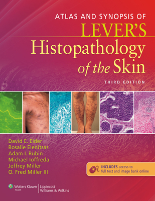 Atlas and Synopsis of Lever's Histopathology of... 1451113447 Book Cover