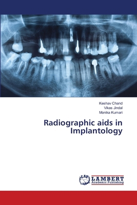 Radiographic aids in Implantology 620842061X Book Cover