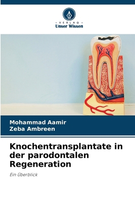 Knochentransplantate in der parodontalen Regene... [German] 6208634652 Book Cover
