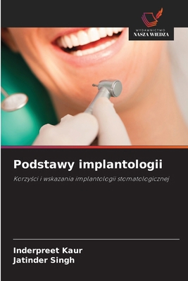 Podstawy implantologii [Polish] 6202209372 Book Cover