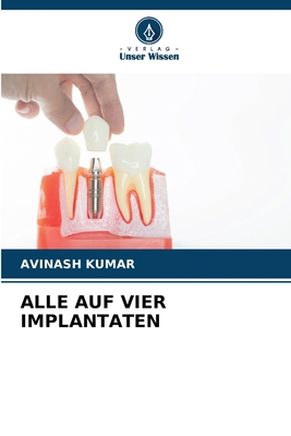 Alle Auf Vier Implantaten [German] 6208300401 Book Cover