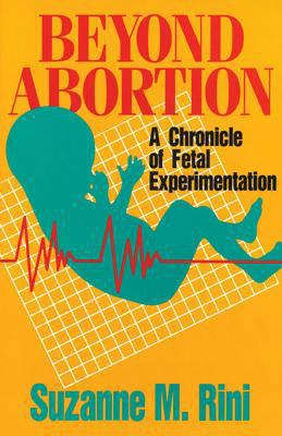 Beyond Abortion: A Chronicle of Fetal Experimen... 0895554879 Book Cover
