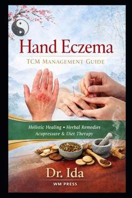 Hand Eczema TCM Management Guide B0GCZKYT29 Book Cover