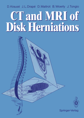 CT and MRI of Disk Herniations 3642735932 Book Cover