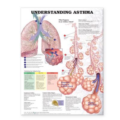 Understanding Asthma Anatomical Chart 1587799383 Book Cover