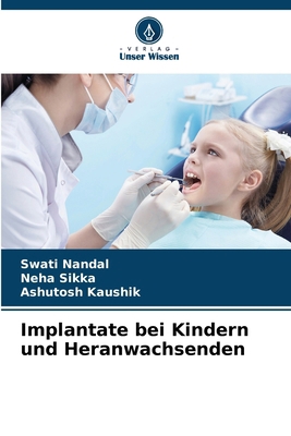 Implantate bei Kindern und Heranwachsenden [German] 6208250641 Book Cover