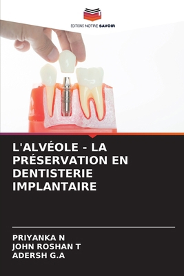 L'Alvéole - La Préservation En Dentisterie Impl... [French] 6208230810 Book Cover