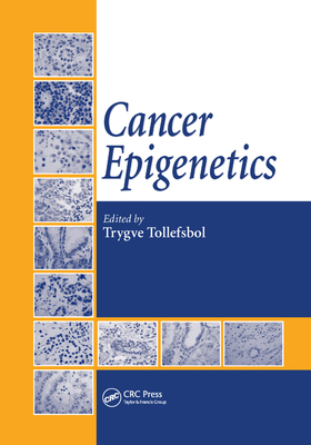 Cancer Epigenetics 0367386860 Book Cover
